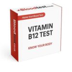 Vitamin B12 Blood Test: Key Insights for Southampton Locals