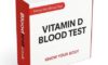 Vitamin D Blood Test: Importance for Canterbury Residents